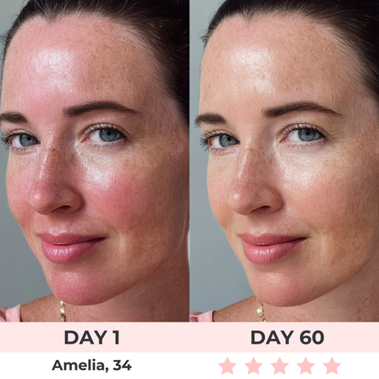Calvonic™ - LED Face Mask